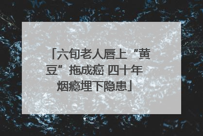 六旬老人唇上“黄豆”拖成癌 四十年烟瘾埋下隐患